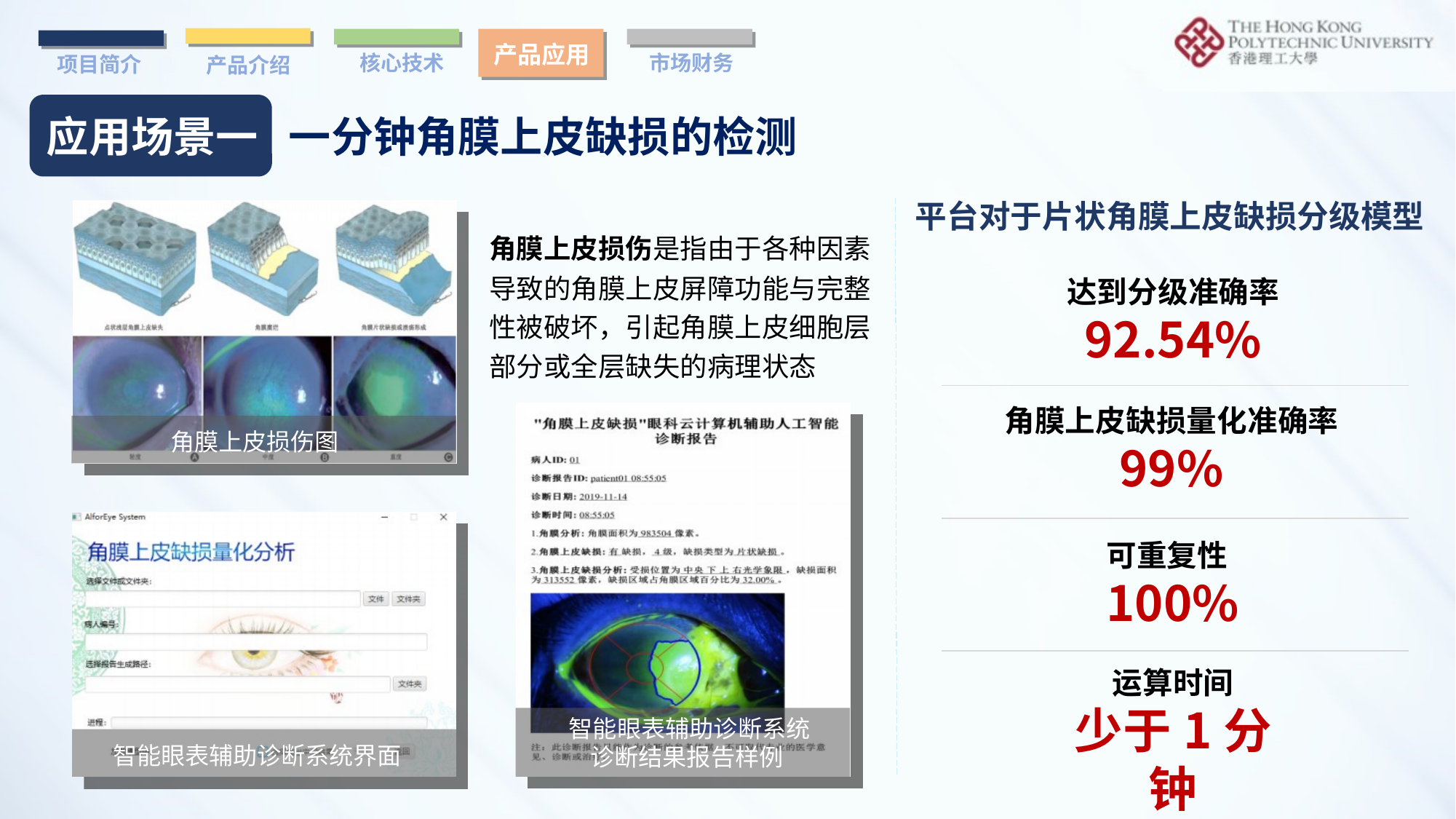 角膜上皮缺损检测